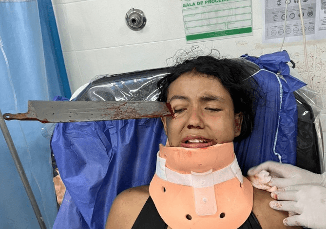 Lesionan con cuchillo a niña en Colombia